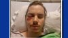 Photographer struck in the eye by LAPD's rubber bullet during LA protest